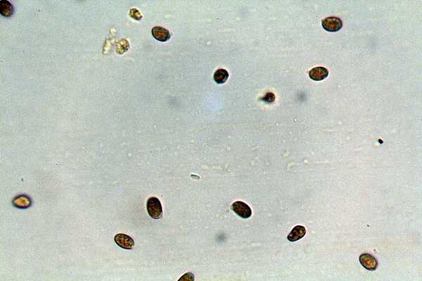 Gloeocystidiellum karstenii? (Laxitextum bicolor)